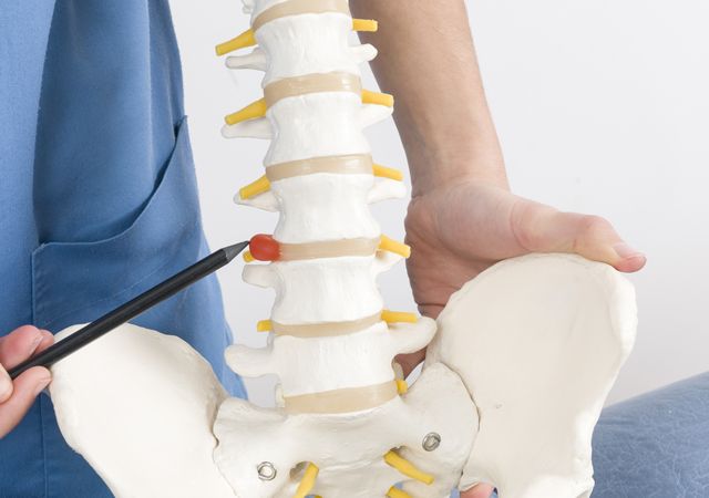 Chirurgie de la colonne vertébrale