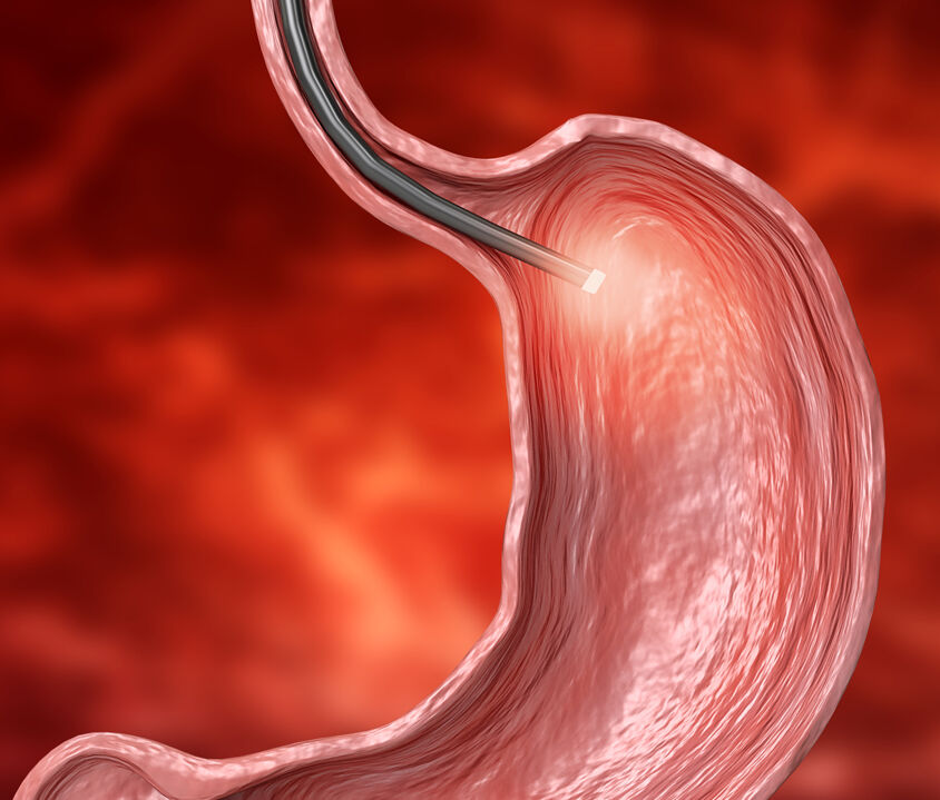 Exploration Digestive