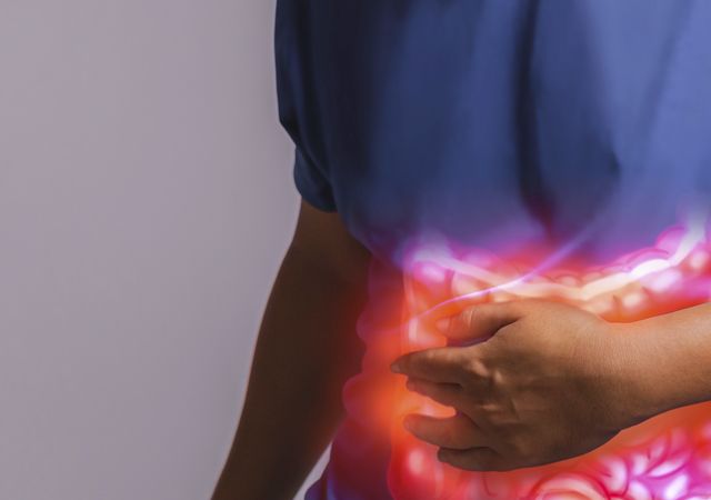 Cancer du côlon : la maladie