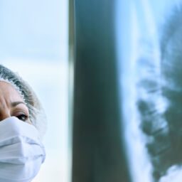 Comprendre le cancer du poumon : symptômes, causes et traitements