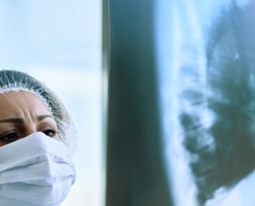 Comprendre le cancer du poumon : symptômes, causes et traitements