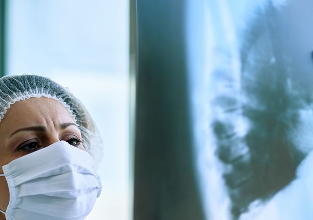 Comprendre le cancer du poumon : symptômes, causes et traitements