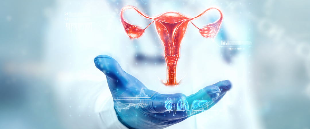 Kyste ovarien : tout ce que vous devez savoir