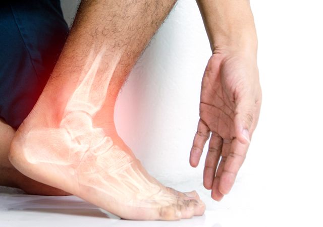 Tout ce que vous devez savoir sur la chirurgie de la cheville