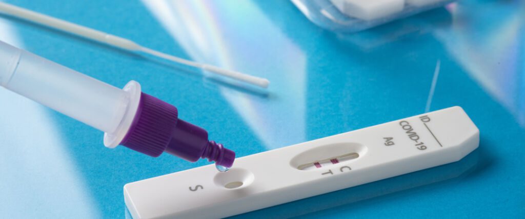 Comprendre le test PCR : ce que vous devez savoir
