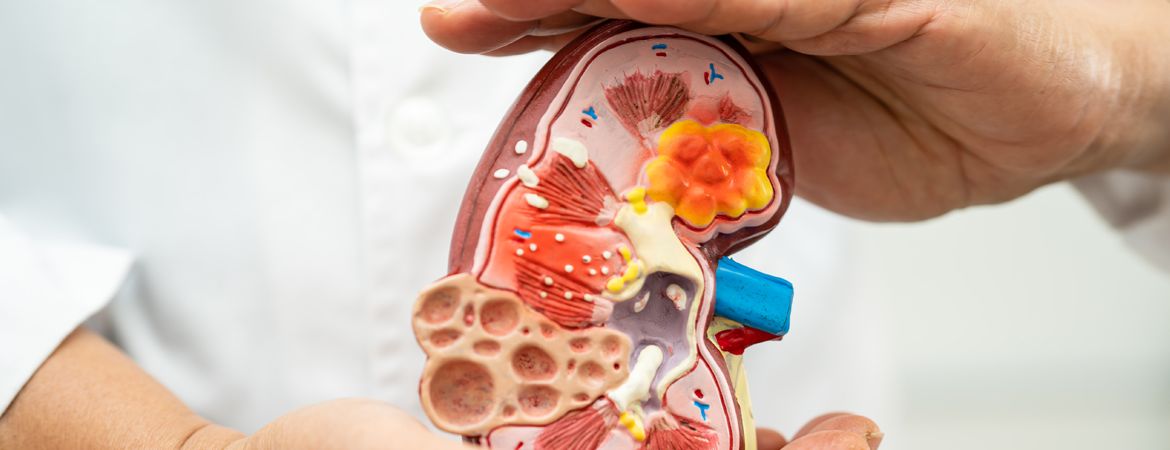 Comprendre la néphrologie en Tunisie : tout ce que vous devez savoir sur les maladies rénales