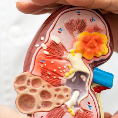 Comprendre la néphrologie en Tunisie : tout ce que vous devez savoir sur les maladies rénales