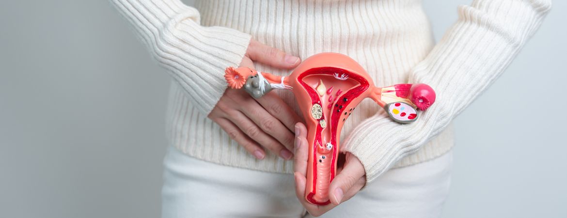 Comprendre l'endométriose : symptômes, causes et traitements