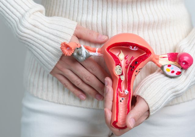 Comprendre l'endométriose : symptômes, causes et traitements