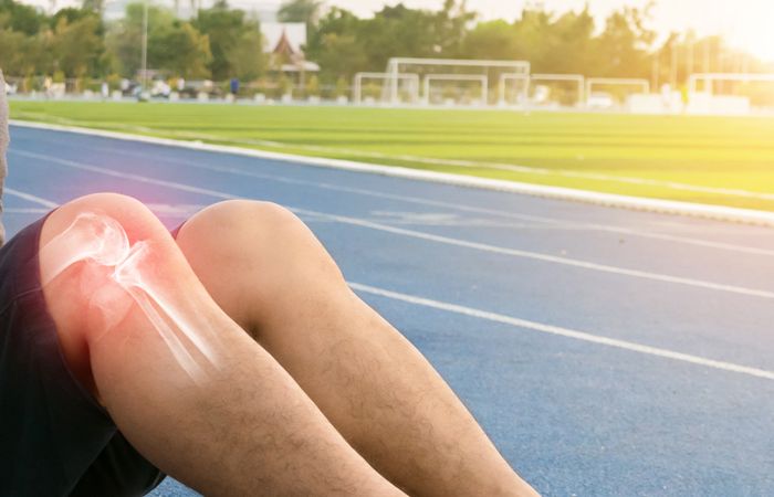Rupture des ligaments croisés : Tout ce que vous devez savoir