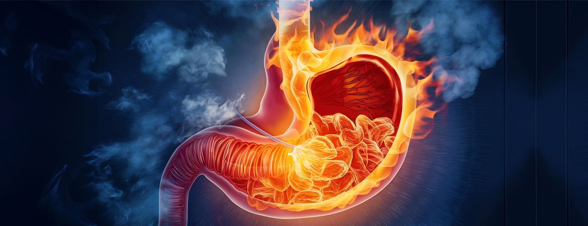 Ulcères et Stress : Mythe ou Réalité ? Découvrez la Vérité Sur Cette Relation Étonnante !