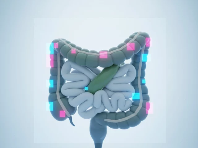 Volvulus : Comprendre cette Urgence Médicale - Symptômes, Traitements et Préventions à Connaître